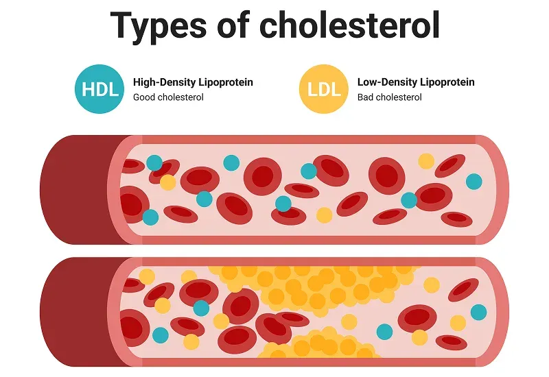 The Different Types of Cholesterol: HDL, LDL, and Triglycerides Explained